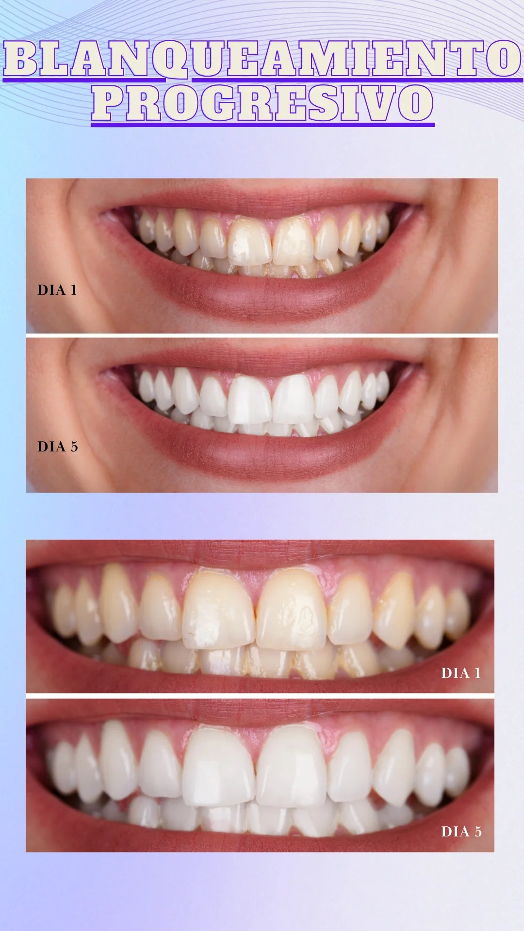 ⭐ PurpleGlow® || Crema Dental Blanqueadora