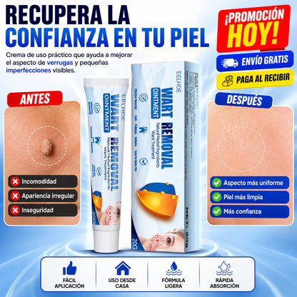 Wart Removal™ Crema para Verrugas y Limpieza Visible de la Piel